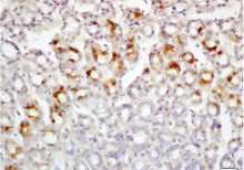 Polyclonal Antibody