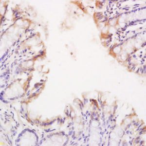 Polyclonal Antibody